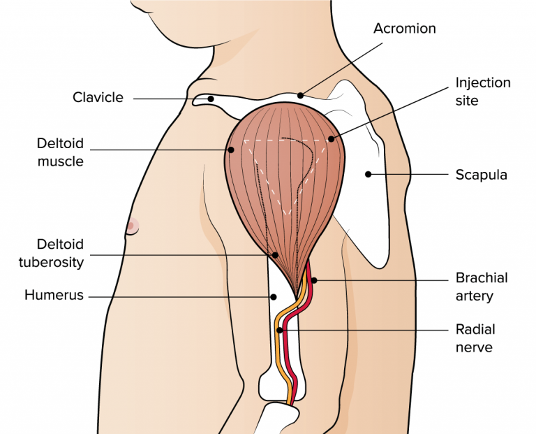 Anatomical markers used to identify the deltoid injection site Figure showing the anatomical markers used to identify the deltoid injection site.
