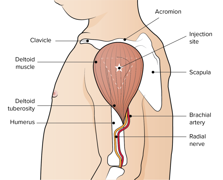 Anatomical markers used to identify the deltoid injection site